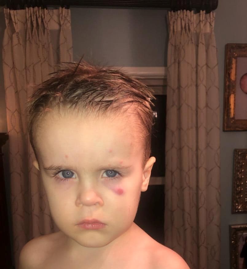 When our littles experience&nbsp;stress